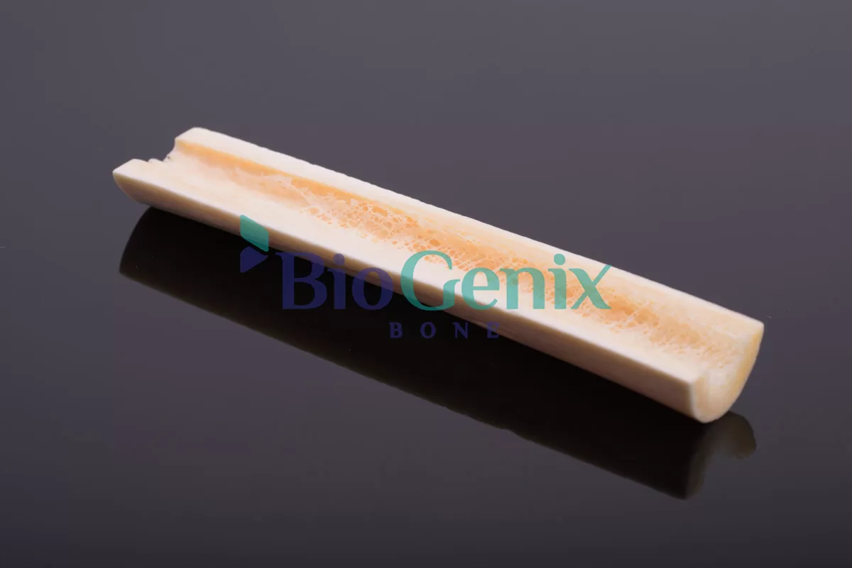 Hemi Femoral Shaft